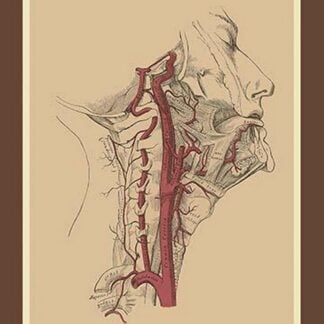 Internal Carotid Artery