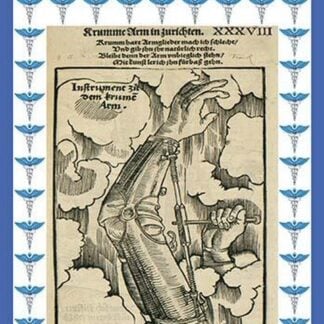 Prosthetics by Paracelsus