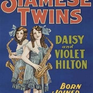 Siamese Twins - Daisy and Violet Hilton