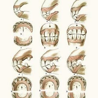 Teeth Plate Description by Samuel Sidney