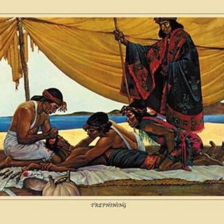 Trephining by Robert Thom